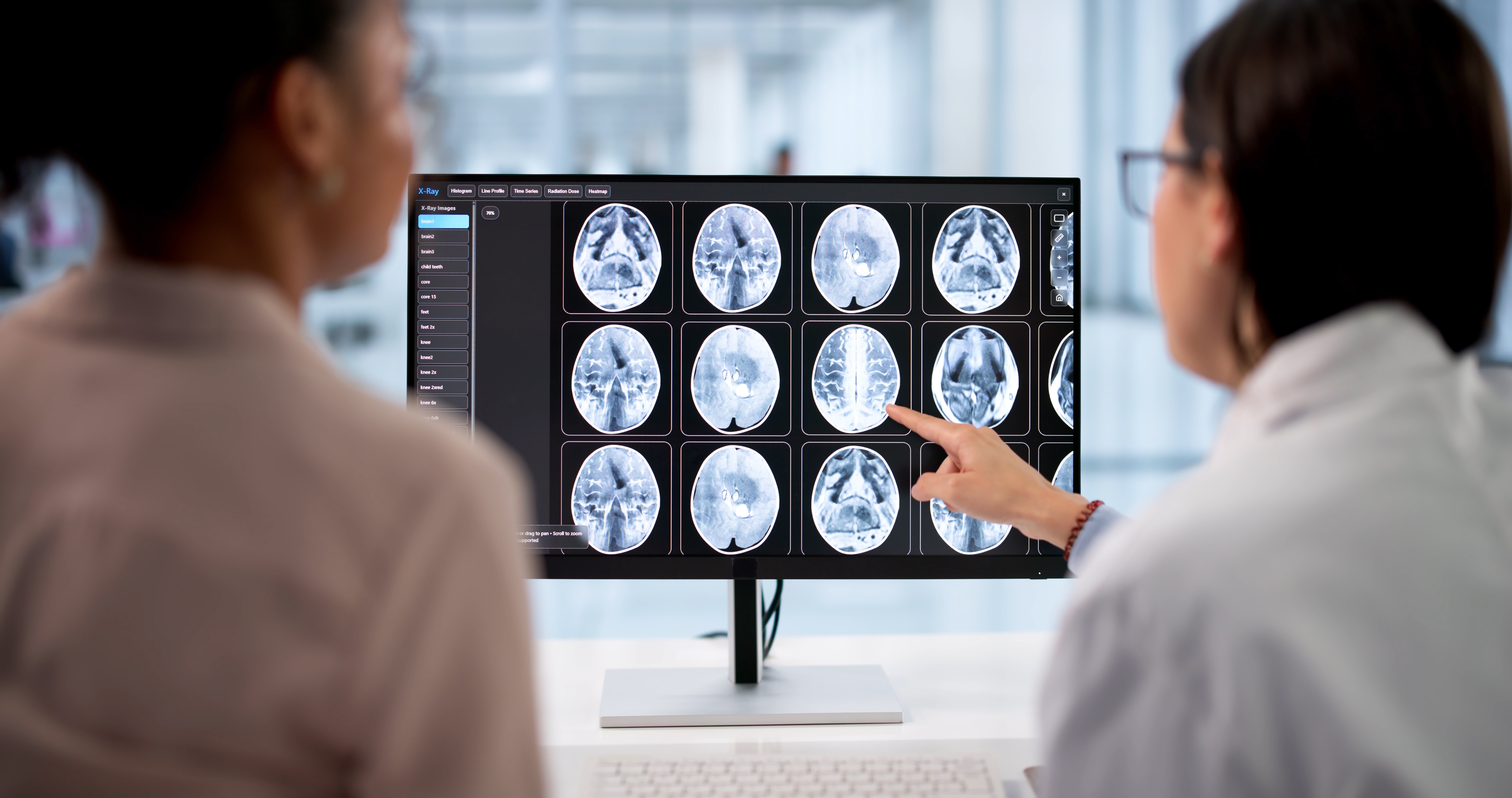 Two healthcare professionals review a series of brain imaging scans displayed on a desktop monitor in a clinical setting. One professional points to a specific image on the screen while the other observes the results. The monitor shows multiple cross-sectional brain scans arranged in a grid, along with medical imaging software menus and controls. The bright, modern workspace features a computer keyboard and a softly blurred background, emphasizing the collaborative review of diagnostic imaging for treatment planning or patient care.